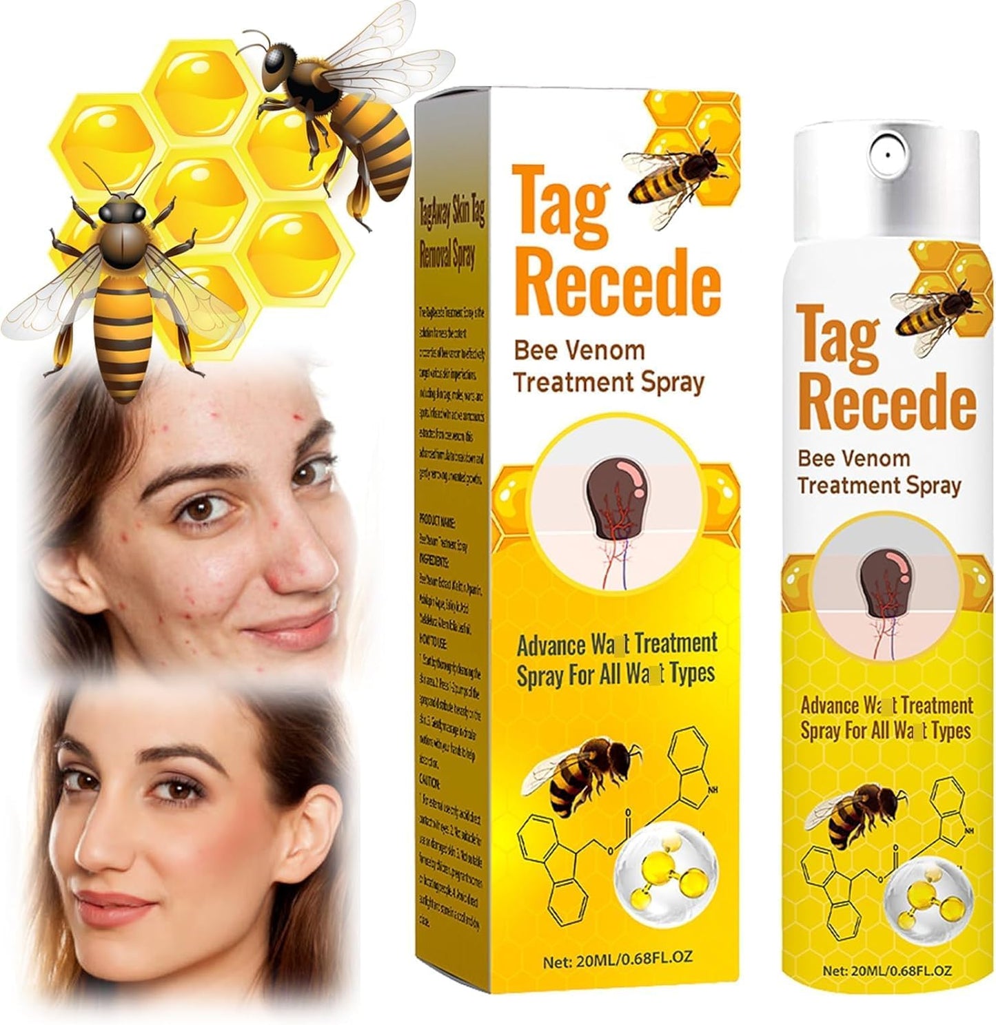 Sprej per lytha (Krem blete per lytha)